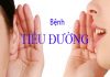 Những điều cần biết về bệnh tiểu đường?