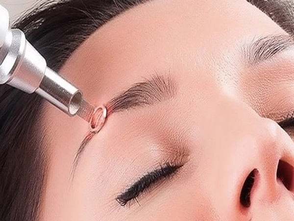 Hướng dẫn chăm sóc lông mày sau xóa laser hiệu quả