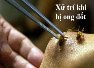 cách trị ong đốt bị sưng ngứa