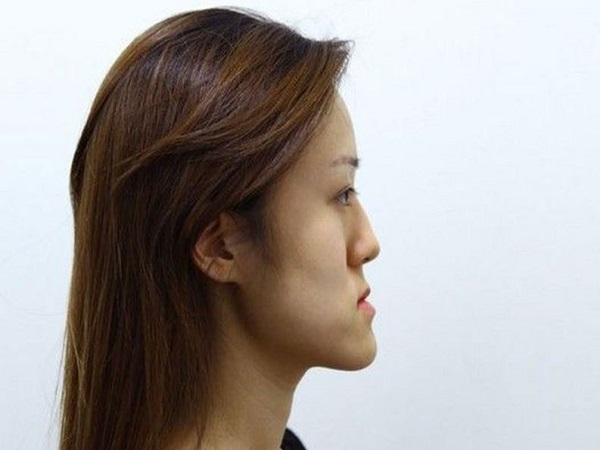 Nhận diện tướng mặt lưỡi cày