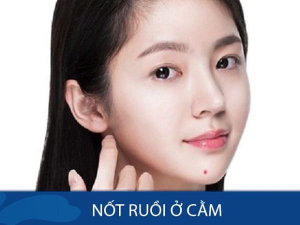Nốt ruồi ở cằm là 1 trong 9 nốt ruồi tài lộc