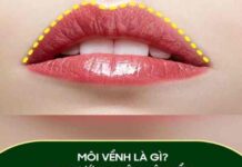 môi trên vểnh lên